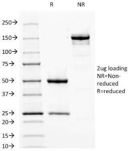 Antibody anti-FASCIN FSCN1417 BSA 100 µg