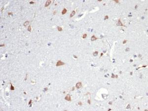 Immunohistochemical analysis of formalin-fixed, paraffin-embedded human brain using Anti-Osteopontin Antibody [OSP/4589]