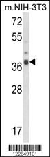 Anti-ARPC1B Rabbit Polyclonal Antibody