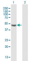 Anti-CRELD1 Rabbit Polyclonal Antibody