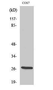 Western blot analysis of various cells using Anti-ERAB Antibody