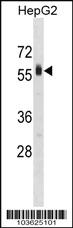 Anti-SPHK2 Rabbit Polyclonal Antibody