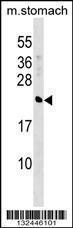 Anti-CRYBA4 Rabbit Polyclonal Antibody