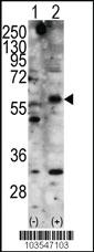 Anti-STK11 Rabbit Polyclonal Antibody