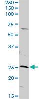 Anti-AK3 Rabbit Polyclonal Antibody