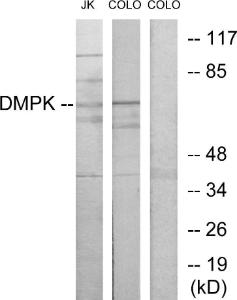 Western blot analysis of lysates from Jurkat and COLO205 cells using Anti-DMPK Antibody. The right hand lane represents a negative control, where the antibody is blocked by the immunising peptide.