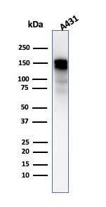 Anti-EGFR antibody