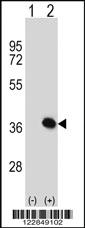 Anti-ARPC1B Rabbit Polyclonal Antibody