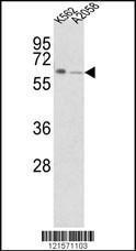 Anti-FPGS Rabbit Polyclonal Antibody (Biotin)