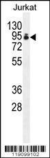 Anti-PAPOLA Rabbit Polyclonal Antibody (APC (Allophycocyanin))