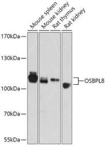 Western blot analysis of extracts of various cell lines, using Anti-ORP8 Antibody (A307228) at 1:1,000 dilution. The secondary antibody was Goat Anti-Rabbit IgG H&L Antibody (HRP) at 1:10,000 dilution.