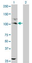 Anti-KIT Mouse Monoclonal Antibody [clone: 1D3]