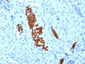 Immunohistochemical analysis of formalin-fixed, paraffin-embedded human tonsil using Anti-alpha 1 Spectrin Antibody [SPTA1/1810]