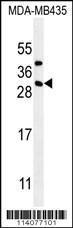 Anti-CD8B Rabbit Polyclonal Antibody