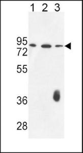 Anti-F12 Rabbit Polyclonal Antibody (Biotin)