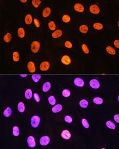 Immunofluorescence analysis of H9C2 cells using Anti-MEIS1 Antibody (A308243) at a dilution of 1:100 DAPI was used to stain the cell nuclei (blue)