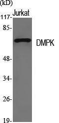 Western blot analysis of various cells using Anti-DMPK Antibody