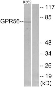 Western blot analysis of lysates from K562 cells using Anti-GPR56 Antibody. The right hand lane represents a negative control, where the antibody is blocked by the immunising peptide