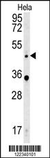 Anti-WNT5A Rabbit Polyclonal Antibody