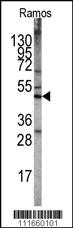 Anti-STK11 Rabbit Polyclonal Antibody