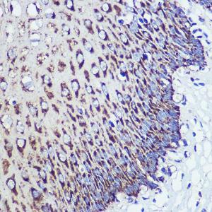 Immunohistochemistry analysis of paraffin-embedded human esophageal using Anti-ORP8 Antibody (A307228) at a dilution of 1:100 (40x lens). Perform microwave antigen retrieval with 10 mM PBS buffer pH 7.2 before commencing with IHC staining protocol.