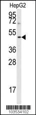 Anti-AURKB Rabbit Polyclonal Antibody