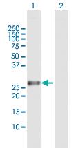 Anti-AK3 Rabbit Polyclonal Antibody