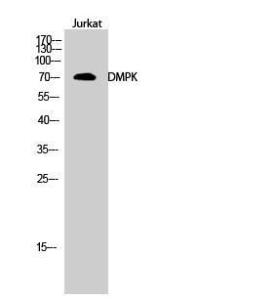 Western blot analysis of Jurkat cells using Anti-DMPK Antibody