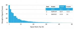 Anti-EGFR antibody