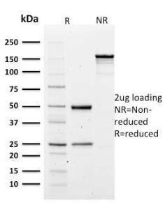 SDS-PAGE analysis of Anti-alpha 1 Spectrin Antibody [SPTA1/1810] under non-reduced and reduced conditions; showing intact IgG and intact heavy and light chains, respectively. SDS-PAGE analysis confirms the integrity and purity of the antibody.