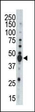 Anti-AURKB Rabbit Polyclonal Antibody