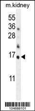 Anti-HRK Rabbit Polyclonal Antibody