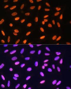 Immunofluorescence analysis of U2OS cells using Anti-MEIS1 Antibody (A308243) at a dilution of 1:100 DAPI was used to stain the cell nuclei (blue)