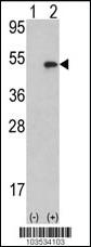 Anti-AURKB Rabbit Polyclonal Antibody