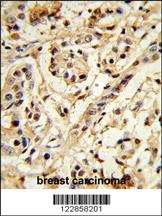 Anti-BMI1 Rabbit Polyclonal Antibody