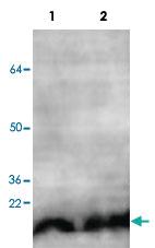 Anti-NUDT1 Rabbit Polyclonal Antibody