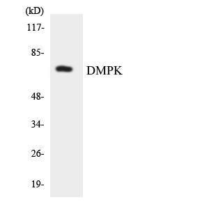 Western blot analysis of the lysates from HT 29 cells using Anti-DMPK Antibody