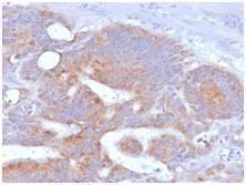 Immunohistochemical analysis of formalin-fixed, paraffin-embedded human colon using Anti-CD86 Antibody [rC86/1146]