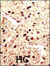 Anti-AURKB Rabbit Polyclonal Antibody