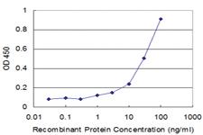 Anti-TLR6 Mouse Monoclonal Antibody [clone: 1A5]