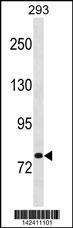 Anti-CHM Rabbit Polyclonal Antibody (APC (Allophycocyanin))