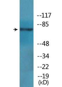 Western blot analysis of lysates from HT29 cells treated with insulin 0.01U/ml 15' using Anti-GRK2 (phospho Ser685) Antibody