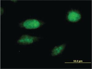 Anti-FOXC2 Mouse Monoclonal Antibody [clone: 2H3]