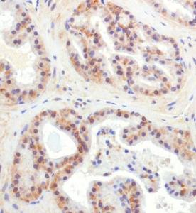 Anti-CHORDC1 Rabbit Polyclonal Antibody