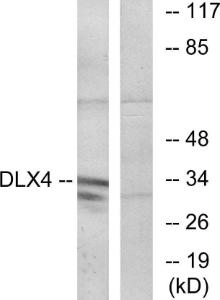 Antibody anti-DLX4 100 µg