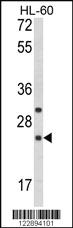 Anti-RGS1 Rabbit Polyclonal Antibody