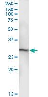 Anti-AK3 Rabbit Polyclonal Antibody