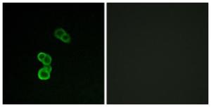 Immunofluorescence analysis of MCF-7 cells using Anti-GAP43 (phospho Ser41) Antibody. The right hand panel represents a negative control, where the antibody was pre-incubated with the immunising peptide