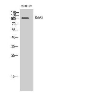 Western blot analysis of 293T UV cells using Anti-EPHA3 Antibody