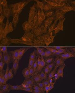 Immunofluorescence analysis of C6 cells using Anti-Retinoic Acid Receptor alpha Antibody (A12622) at a dilution of 1:100 (40X lens). DAPI was used to stain the cell nuclei (blue)